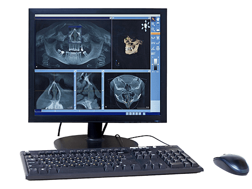 Monitor Showing an X-Ray of Teeth