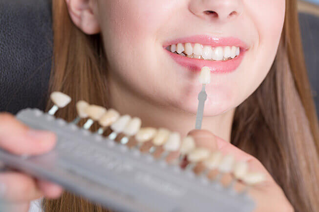 Woman Comparing the Color of Veneers to Her Teeth